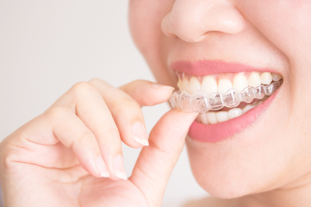 teeth with invisalign
