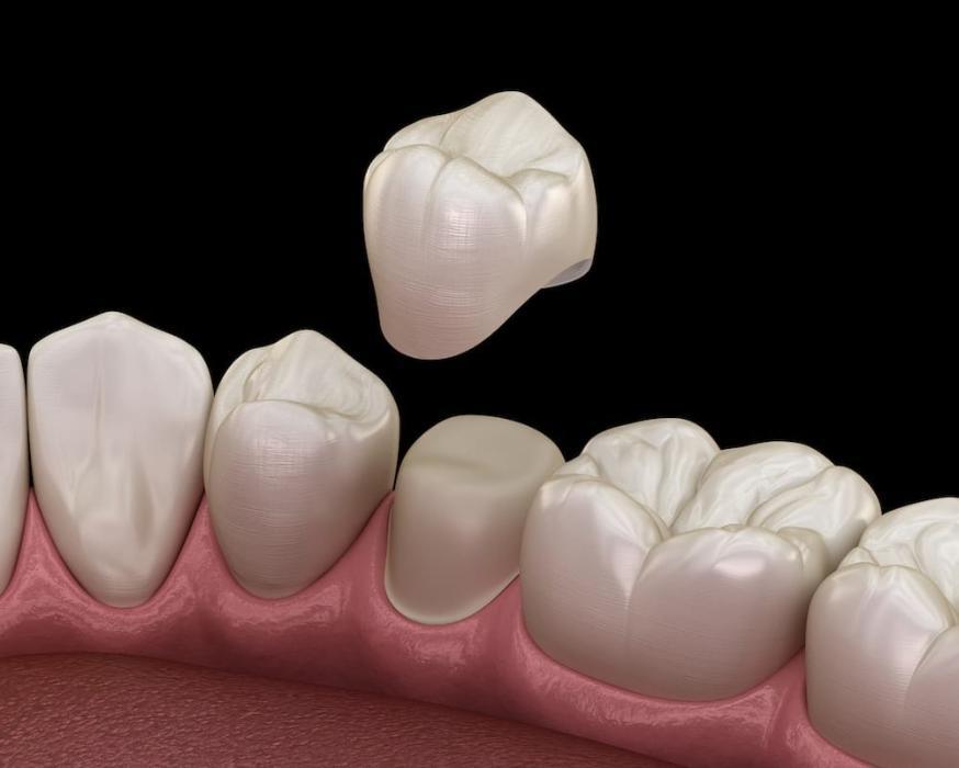 graphic of a crown with teeth