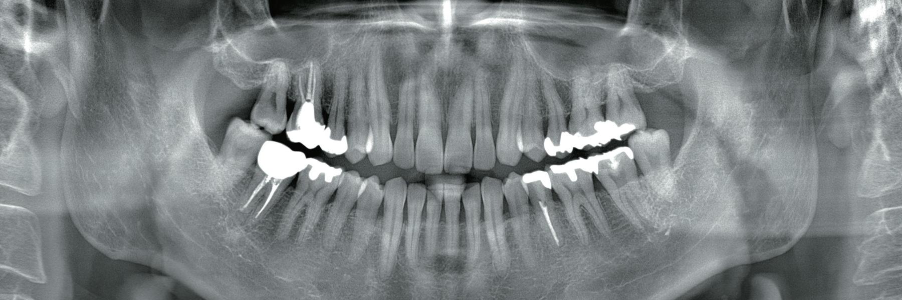 Girl smiling after dentist appointment