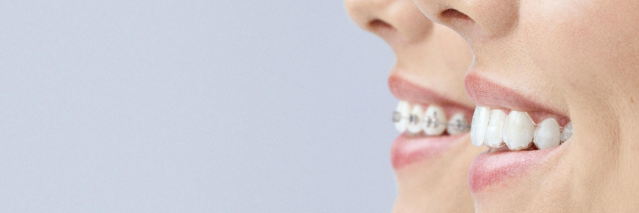 people embracing outside l orthodontist melbourne cbd