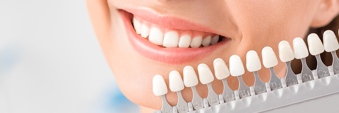 Girl having her teeth whitened l dentist melbourne